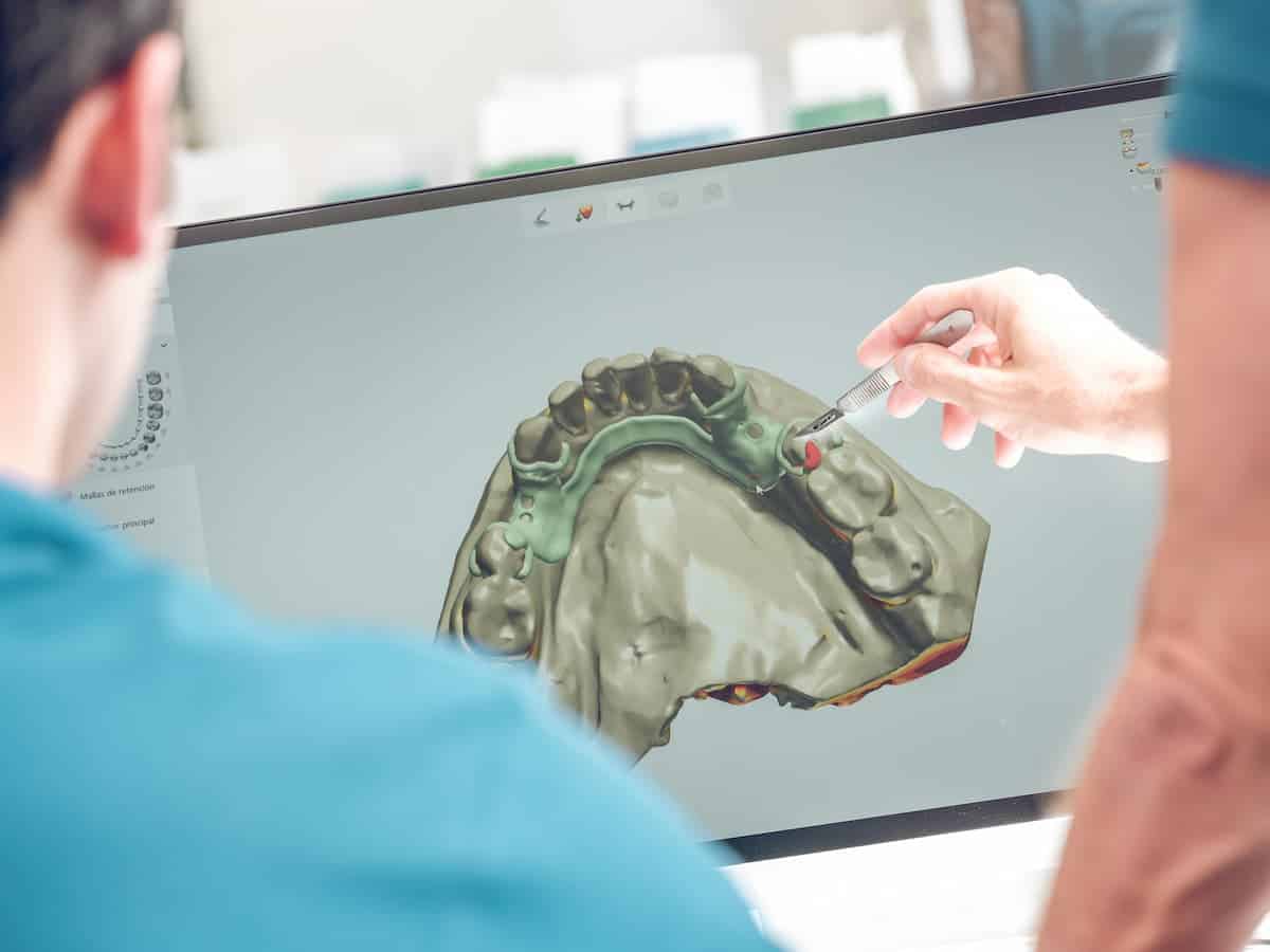 dentist showing digital model of teeth