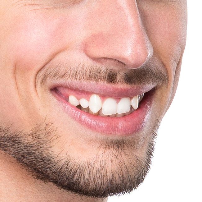 Smile