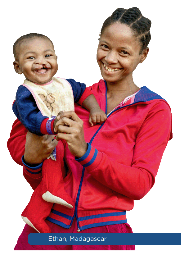 A mother and child supported by Operation Smile