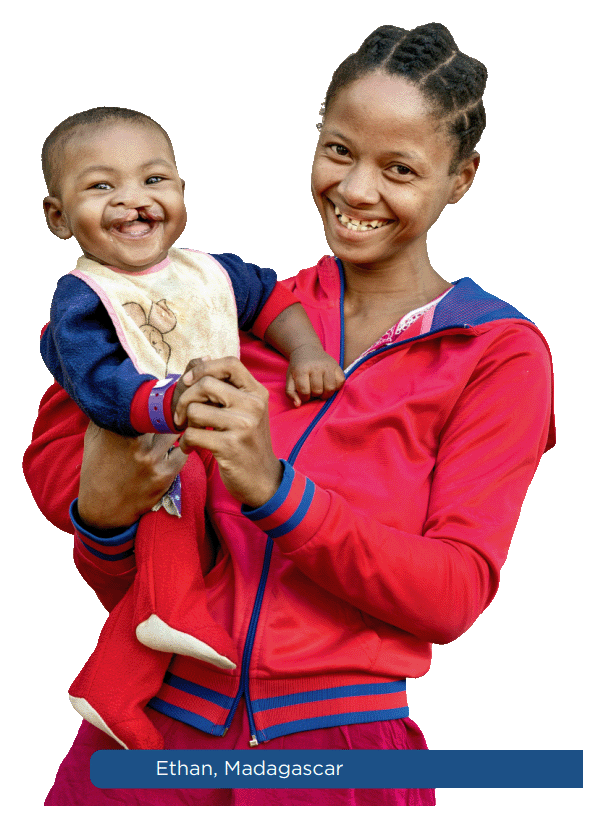 A mother and child supported by Operation Smile
